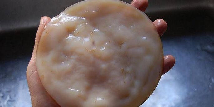 Kombucha gegen Nagelpilz