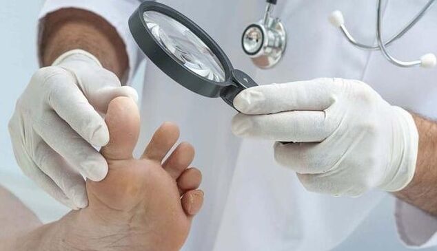 Pilzdiagnose.